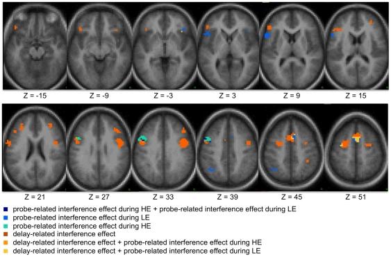 https://cdn.ncbi.nlm.nih.gov/pmc/blobs/e221/2942897/6b8ce3de7320/pone.0012861.g001.jpg
