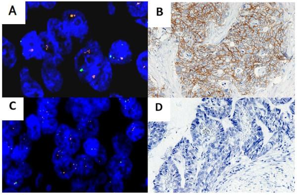 https://cdn.ncbi.nlm.nih.gov/pmc/blobs/e227/3937244/2415f4903cff/1746-1596-8-191-1.jpg