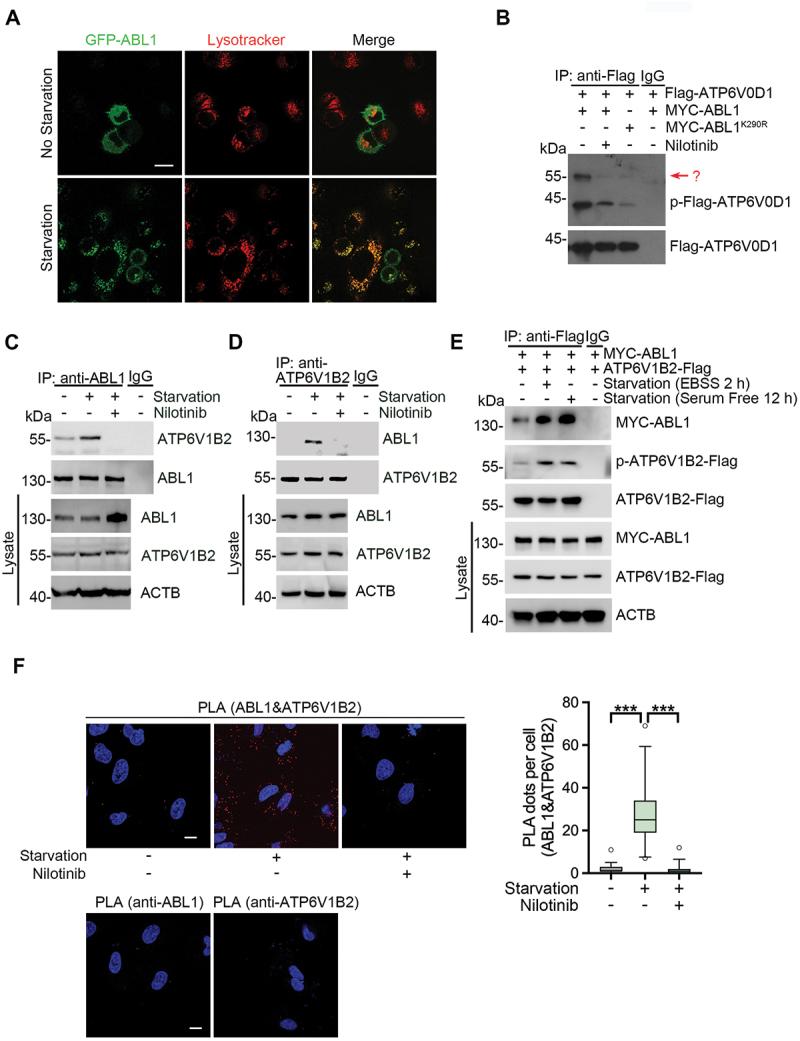 https://cdn.ncbi.nlm.nih.gov/pmc/blobs/e228/12087662/5ea2269b8bde/KAUP_A_2448913_F0001_C.jpg