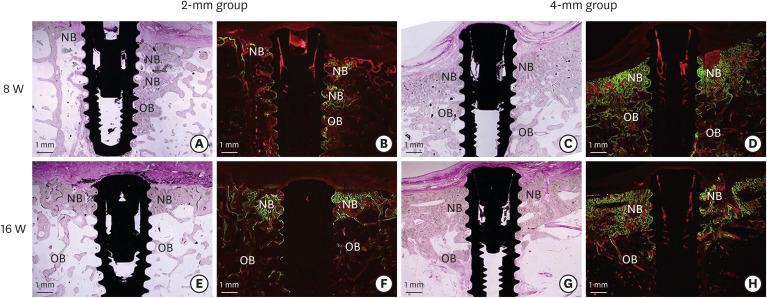 https://cdn.ncbi.nlm.nih.gov/pmc/blobs/e228/9614175/dfa41857f213/jpis-52-422-g006.jpg