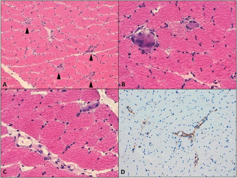 https://cdn.ncbi.nlm.nih.gov/pmc/blobs/e22a/7558229/c59291feca3b/gr3_lrg.jpg