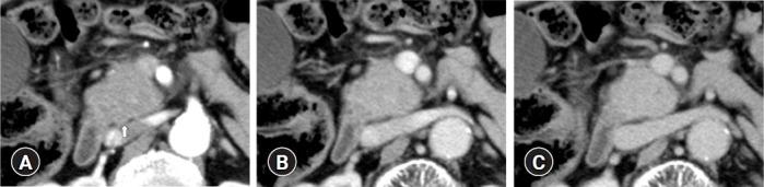 https://cdn.ncbi.nlm.nih.gov/pmc/blobs/e231/10393566/52cbc6b15514/ce-2022-142f1.jpg