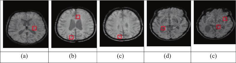 https://cdn.ncbi.nlm.nih.gov/pmc/blobs/e232/12410576/59a571830884/gr5.jpg