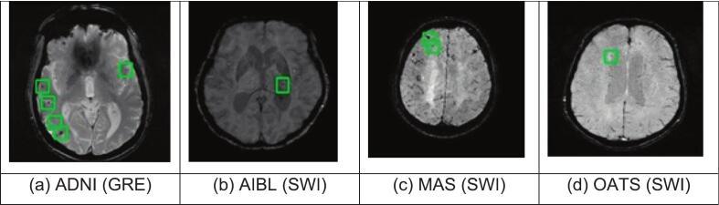 https://cdn.ncbi.nlm.nih.gov/pmc/blobs/e232/12410576/c1f45bb5f6bf/gr2.jpg