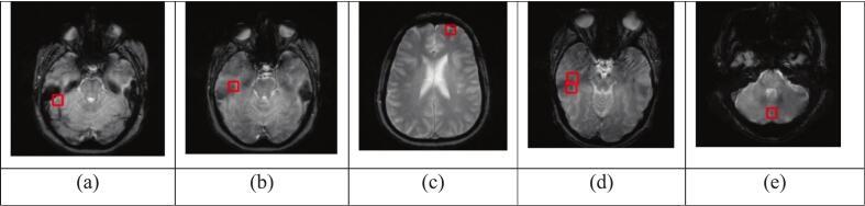 https://cdn.ncbi.nlm.nih.gov/pmc/blobs/e232/12410576/eb238694f5e5/gr4.jpg