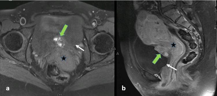 https://cdn.ncbi.nlm.nih.gov/pmc/blobs/e233/8327303/3c5aa7fddf20/cureus-0013-00000016133-i03.jpg