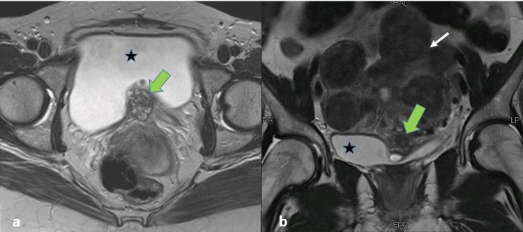 https://cdn.ncbi.nlm.nih.gov/pmc/blobs/e233/8327303/5b49dca0caf0/cureus-0013-00000016133-i02.jpg