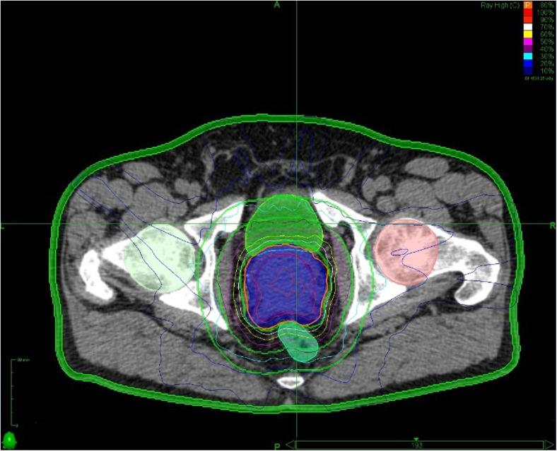 https://cdn.ncbi.nlm.nih.gov/pmc/blobs/e236/5366169/9443015eff13/11912_2017_584_Fig1_HTML.jpg