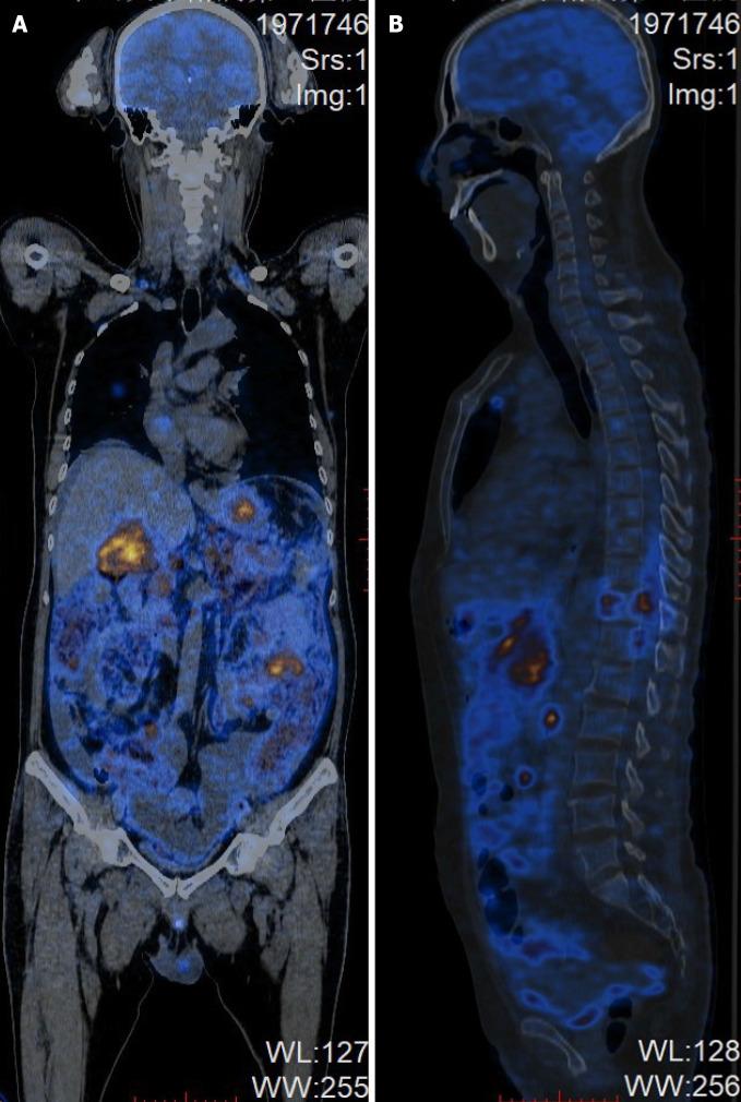 https://cdn.ncbi.nlm.nih.gov/pmc/blobs/e246/8661376/5f2676efc092/WJG-27-7844-g003.jpg
