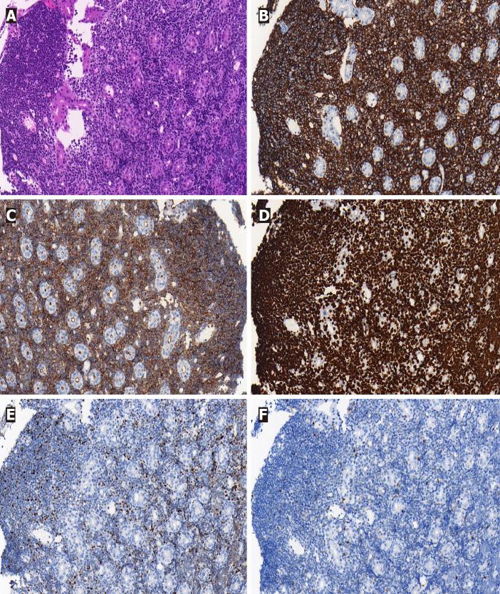 https://cdn.ncbi.nlm.nih.gov/pmc/blobs/e246/8661376/9b41d1f08e51/WJG-27-7844-g005.jpg