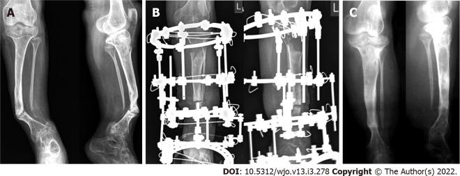 https://cdn.ncbi.nlm.nih.gov/pmc/blobs/e24d/8935333/5b26edfb798e/WJO-13-278-g002.jpg