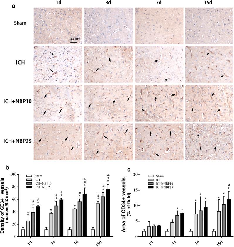 https://cdn.ncbi.nlm.nih.gov/pmc/blobs/e251/7257157/4e5d300dead0/12868_2020_575_Fig4_HTML.jpg