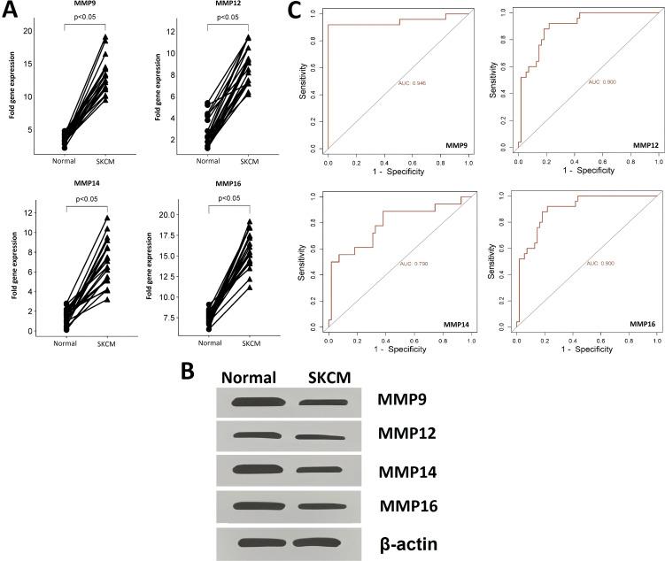 https://cdn.ncbi.nlm.nih.gov/pmc/blobs/e253/11527786/b1096a7a93b1/fonc-14-1471267-g003.jpg