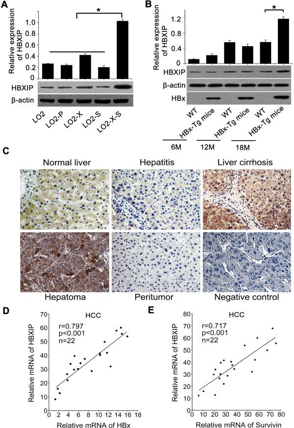 https://cdn.ncbi.nlm.nih.gov/pmc/blobs/e254/4046021/30aee42c5a8f/1476-4598-13-128-3.jpg