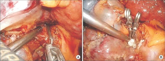 https://cdn.ncbi.nlm.nih.gov/pmc/blobs/e254/5416917/3fec176d33de/astr-92-383-g002.jpg