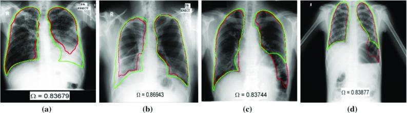 https://cdn.ncbi.nlm.nih.gov/pmc/blobs/e25a/6420899/30b2c82921f4/11548_2019_1917_Fig3_HTML.jpg