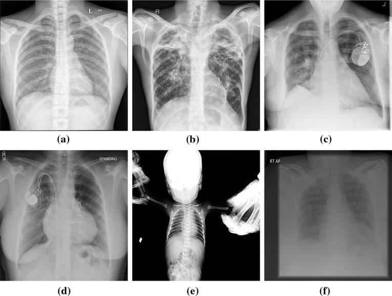 https://cdn.ncbi.nlm.nih.gov/pmc/blobs/e25a/6420899/5db283de42c0/11548_2019_1917_Fig1_HTML.jpg