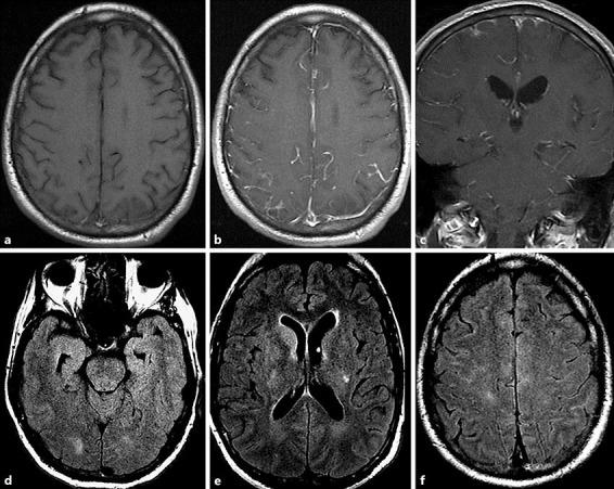 https://cdn.ncbi.nlm.nih.gov/pmc/blobs/e25d/5437444/cee0cb479037/crn-0009-0091-g01.jpg