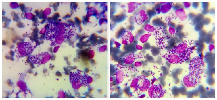 https://cdn.ncbi.nlm.nih.gov/pmc/blobs/e261/10760576/810a4b2db5d3/turkjmedsci-53-6-1767f2.jpg