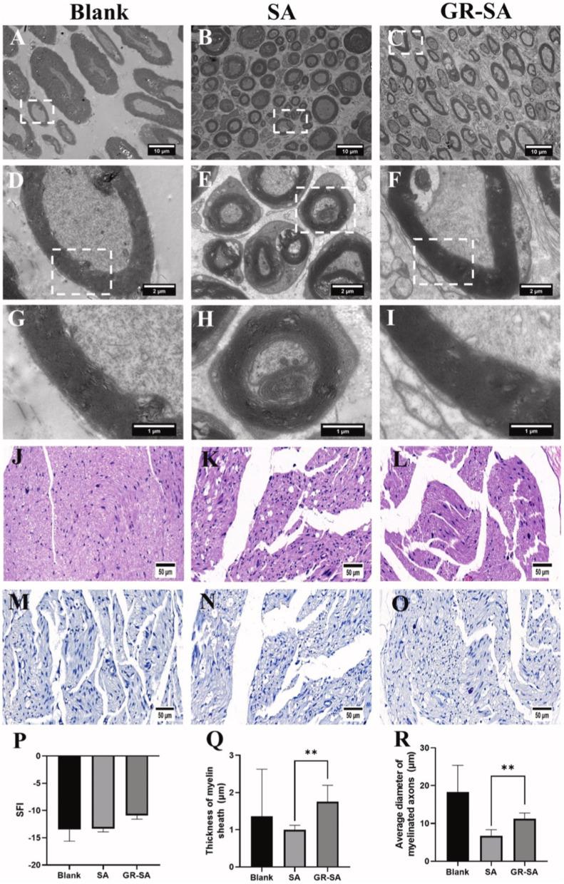 https://cdn.ncbi.nlm.nih.gov/pmc/blobs/e261/11166159/0aa3bd54b787/IJN-19-5459-g0003.jpg