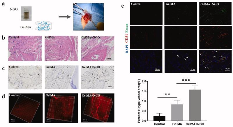 https://cdn.ncbi.nlm.nih.gov/pmc/blobs/e261/11166159/aa97b7bdd985/IJN-19-5459-g0005.jpg