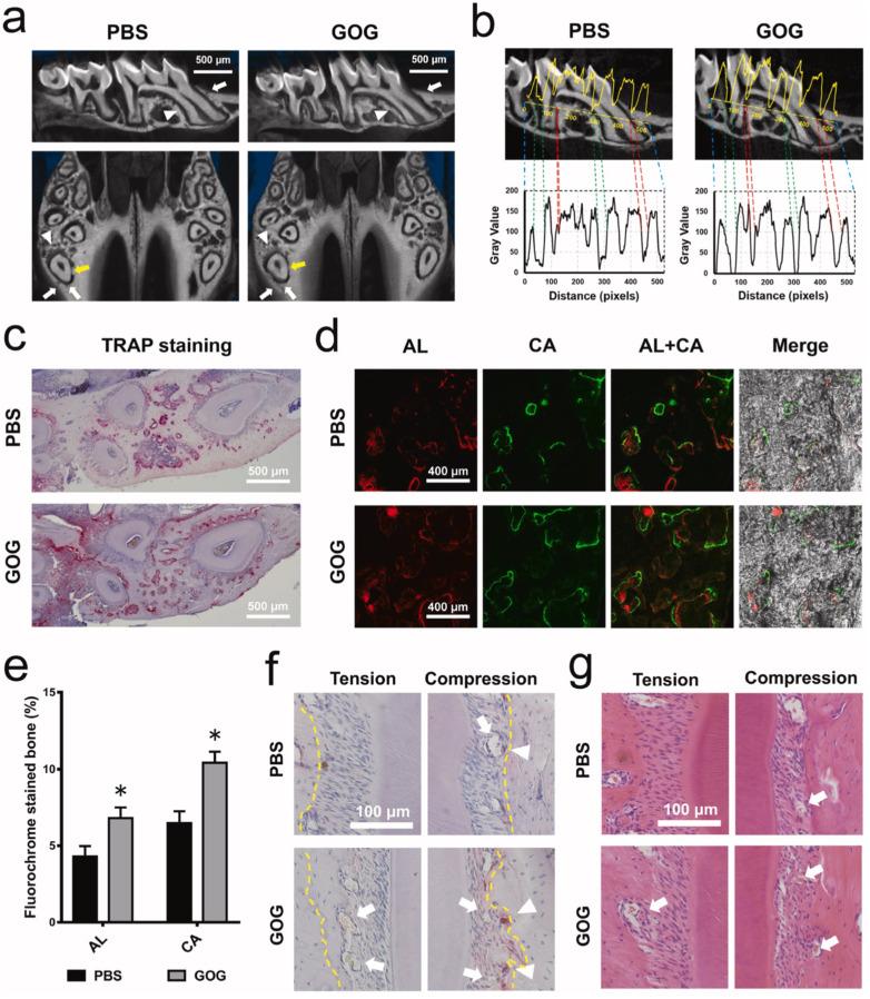 https://cdn.ncbi.nlm.nih.gov/pmc/blobs/e261/11166159/ec7158375082/IJN-19-5459-g0004.jpg