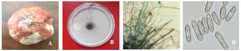 https://cdn.ncbi.nlm.nih.gov/pmc/blobs/e261/9971827/967d1925fcc0/f1000research-9-142811-g0000.jpg