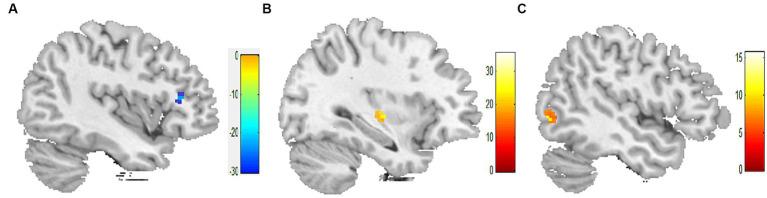 https://cdn.ncbi.nlm.nih.gov/pmc/blobs/e263/10796520/1a9e400e7569/fnins-17-1297149-g001.jpg