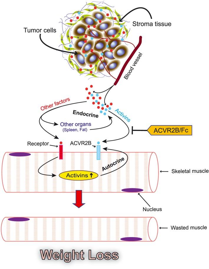 https://cdn.ncbi.nlm.nih.gov/pmc/blobs/e265/6818463/877a8561c118/JCSM-10-1083-g010.jpg