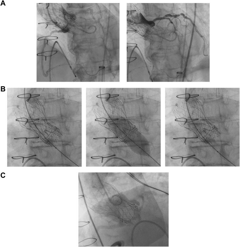 https://cdn.ncbi.nlm.nih.gov/pmc/blobs/e26d/12237724/acd21a6acacf/gr2.jpg