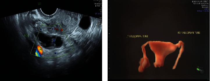 https://cdn.ncbi.nlm.nih.gov/pmc/blobs/e26d/9509259/8d627ae37803/CMMM2022-7508880.002.jpg