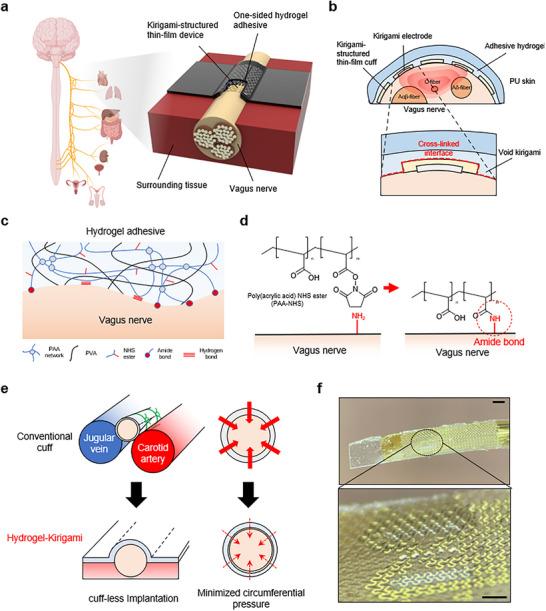 https://cdn.ncbi.nlm.nih.gov/pmc/blobs/e26f/12057590/2d389ea4b1d0/ADHM-14-0-g002.jpg