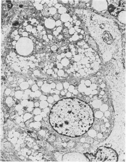 https://cdn.ncbi.nlm.nih.gov/pmc/blobs/e272/1627218/b7f2953b9a86/archdisch00770-0058-a.jpg