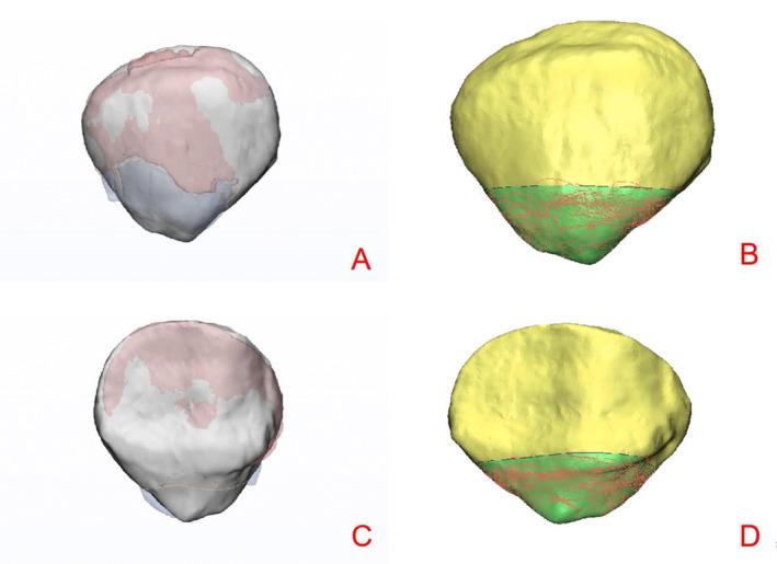 https://cdn.ncbi.nlm.nih.gov/pmc/blobs/e275/11962283/341b944461fe/OS-17-1045-g007.jpg