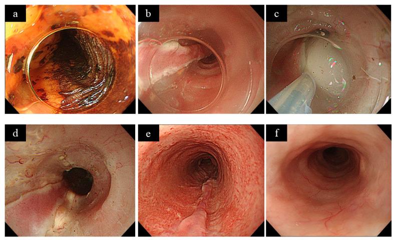 https://cdn.ncbi.nlm.nih.gov/pmc/blobs/e27a/7796365/496be1b2a798/jcm-10-00020-g001.jpg