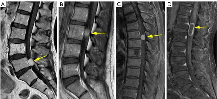 https://cdn.ncbi.nlm.nih.gov/pmc/blobs/e27b/11074726/a325a31f2992/qims-14-05-3628-f3.jpg