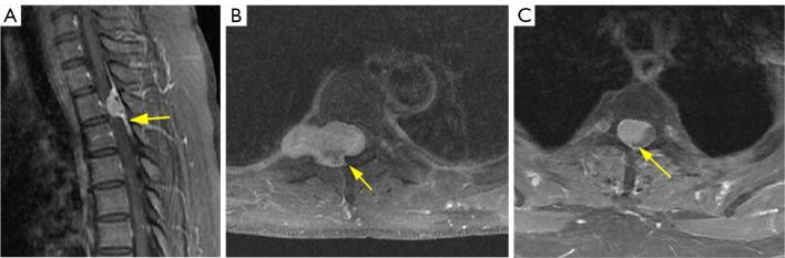 https://cdn.ncbi.nlm.nih.gov/pmc/blobs/e27b/11074726/b29367fe53f9/qims-14-05-3628-f4.jpg