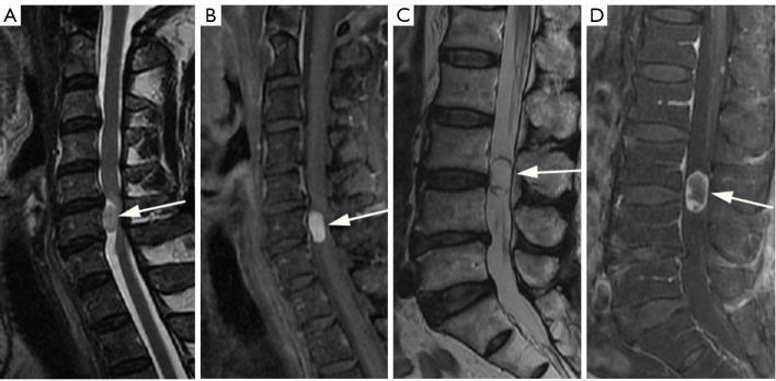 https://cdn.ncbi.nlm.nih.gov/pmc/blobs/e27b/11074726/b360ee422a38/qims-14-05-3628-f7.jpg