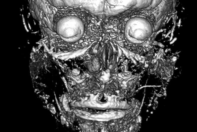 https://cdn.ncbi.nlm.nih.gov/pmc/blobs/e27c/12278983/2e4fbcf87a29/CCID-18-1741-g0008.jpg