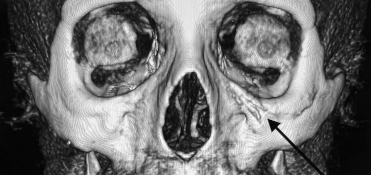 https://cdn.ncbi.nlm.nih.gov/pmc/blobs/e27c/12278983/4249b6f9d57b/CCID-18-1741-g0007.jpg