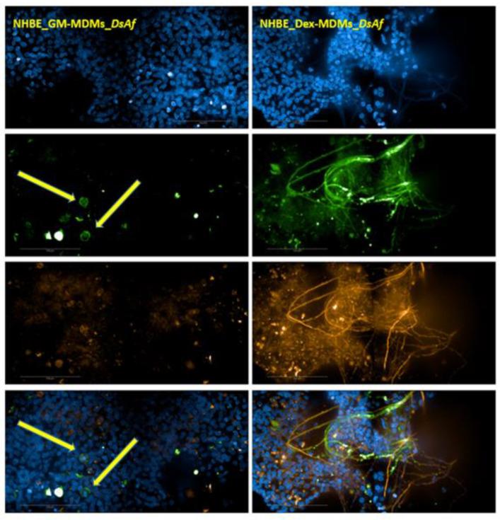 https://cdn.ncbi.nlm.nih.gov/pmc/blobs/e280/8003030/4814a2cc532c/jof-07-00221-g005.jpg