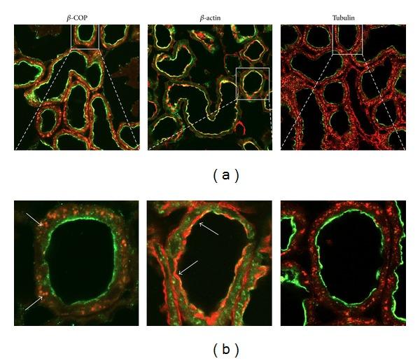 https://cdn.ncbi.nlm.nih.gov/pmc/blobs/e283/3586470/dd72e39b4cd3/BMRI2013-513932.001.jpg