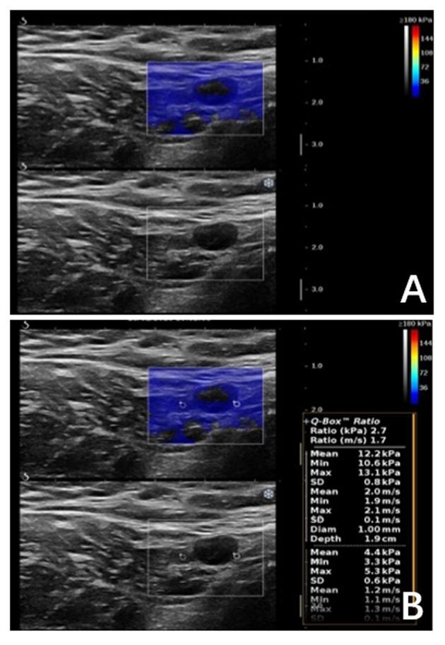 https://cdn.ncbi.nlm.nih.gov/pmc/blobs/e285/6614346/eb09ceea391d/fonc-09-00533-g0005.jpg
