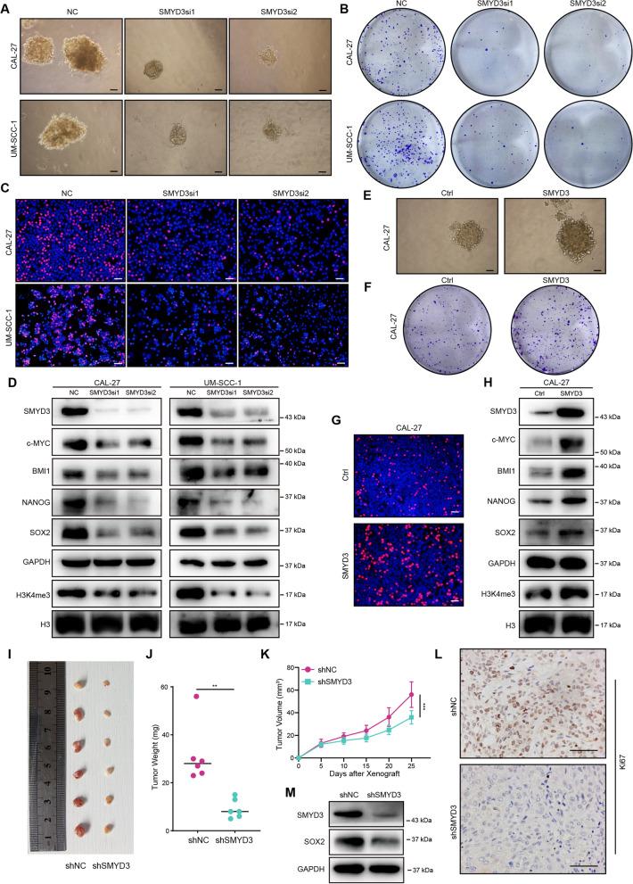 https://cdn.ncbi.nlm.nih.gov/pmc/blobs/e286/10223939/890a9905a70b/13148_2023_1506_Fig4_HTML.jpg