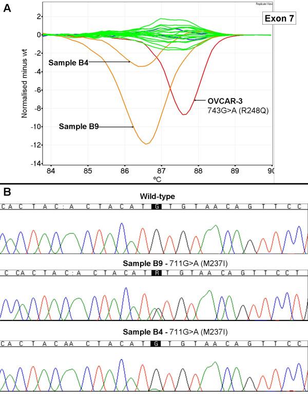 https://cdn.ncbi.nlm.nih.gov/pmc/blobs/e287/2025602/3ae62da75ebf/1471-2407-7-168-7.jpg