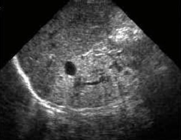 https://cdn.ncbi.nlm.nih.gov/pmc/blobs/e287/3174128/3dc08b9e7df7/1752-1947-5-378-2.jpg