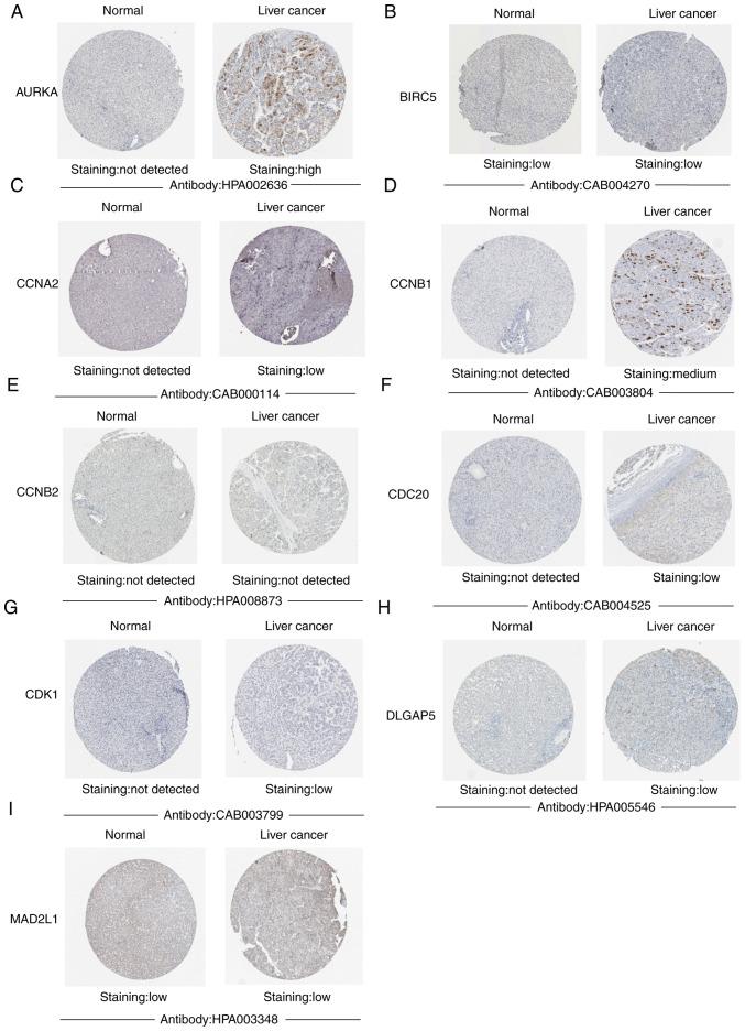 https://cdn.ncbi.nlm.nih.gov/pmc/blobs/e287/8299009/509f32709c56/ol-22-03-12914-g04.jpg