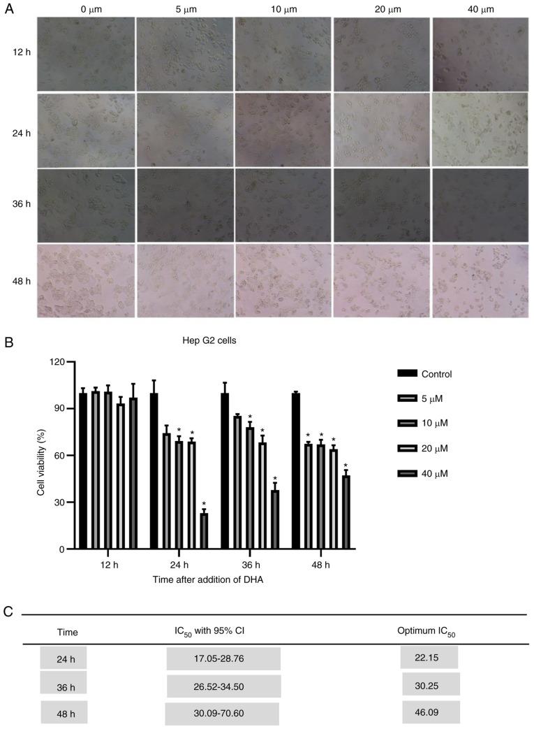 https://cdn.ncbi.nlm.nih.gov/pmc/blobs/e287/8299009/e8f40875d586/ol-22-03-12914-g06.jpg