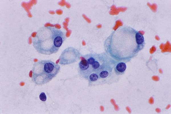 https://cdn.ncbi.nlm.nih.gov/pmc/blobs/e288/1177974/879131750e23/1742-6413-2-7-10.jpg