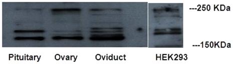 https://cdn.ncbi.nlm.nih.gov/pmc/blobs/e28b/3322132/974b8b259e8e/pone.0033851.g003.jpg